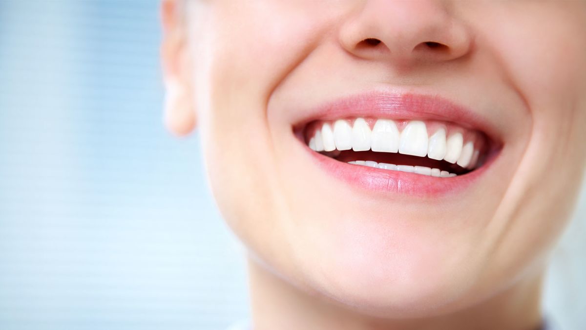 Https cdn.cnn.com cnnnext dam assets 171027135339 teeth white kit